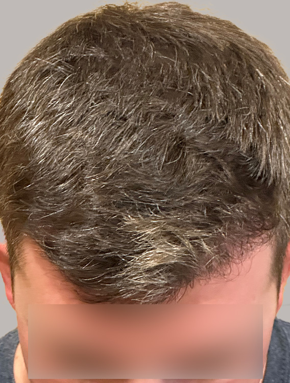 B&A_23_After B&A_23_After