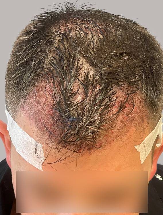 B&A_23_Before B&A_23_Before